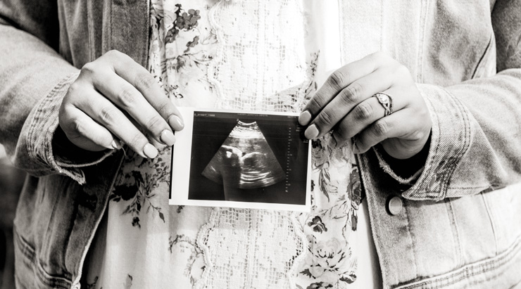 Helping People Grieve: How to Speak About Pregnancy Loss, by Rishma Walji. Photograph of woman holding ultrasound image of fetus, by Edward Cisneros